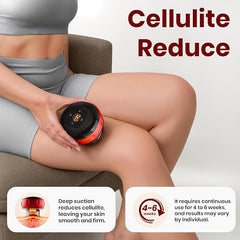 Electric Cupping Massager with Infrared Therapy – Pain Relief & Muscle Recovery