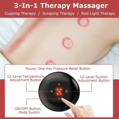 Electric Cupping Massager with Infrared Therapy – Pain Relief & Muscle Recovery